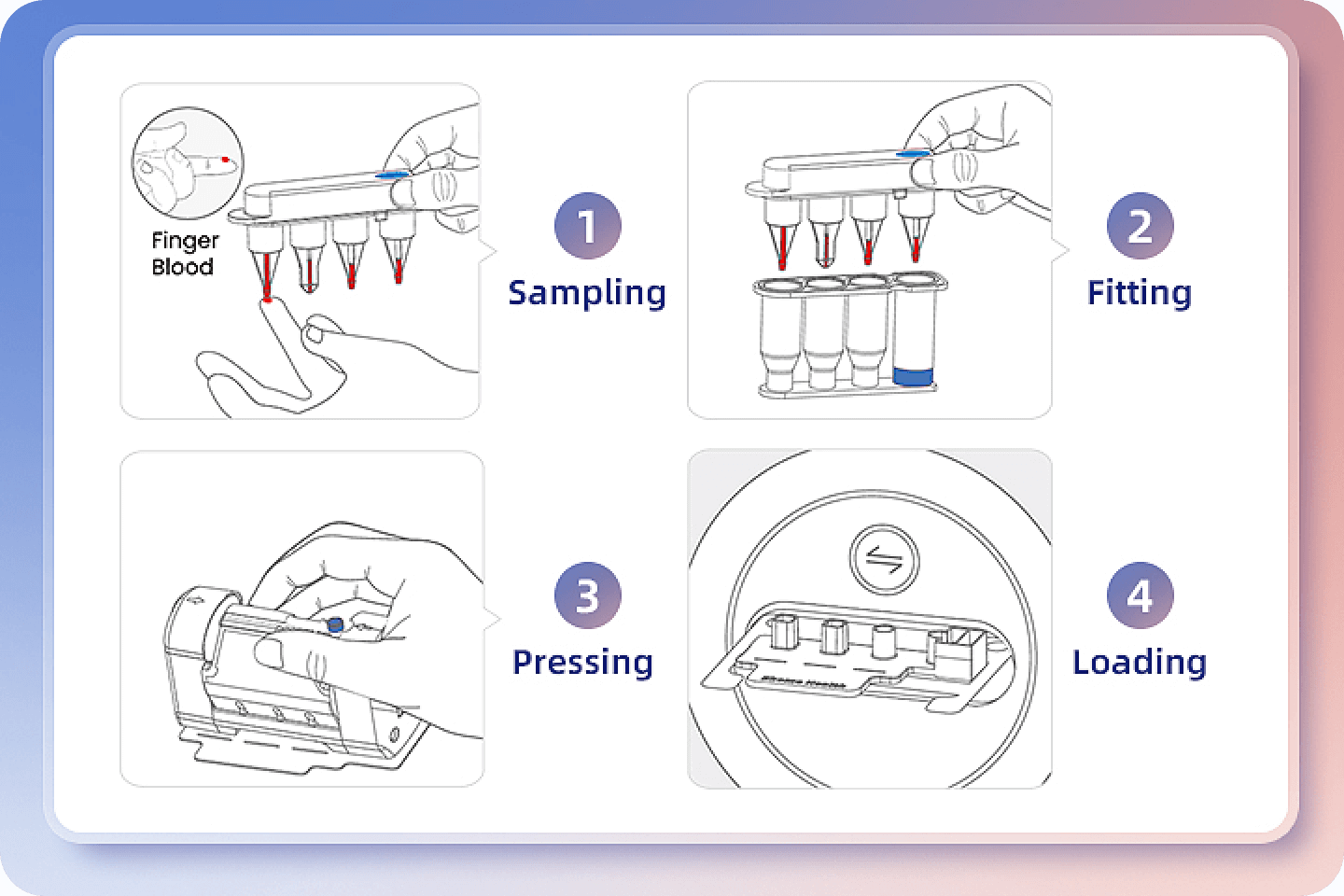 Simplified 4-Step Operation for Primary Care